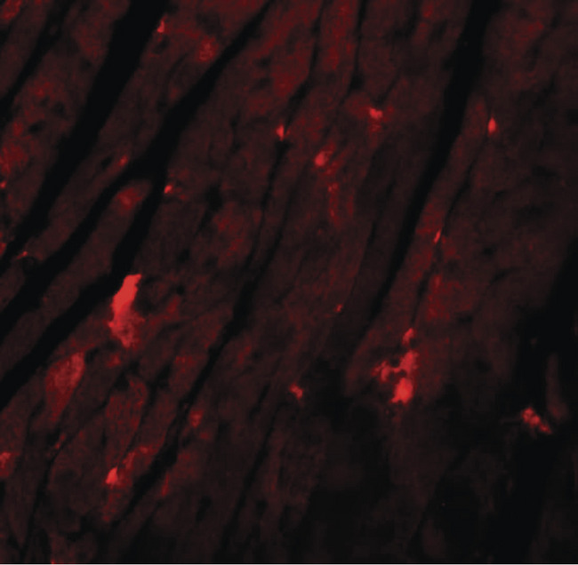 REEP3 Antibody - Immunofluorescence of REEP3 in mouse heart tissue with REEP3 antibody at 20 ug/ml.