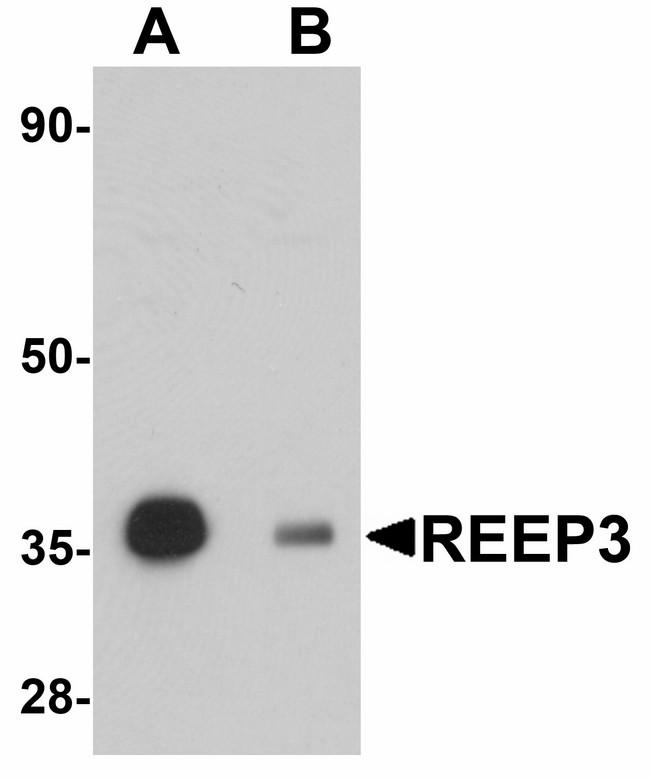 REEP3 Antibody - Western blot of REEP3 in rat heart tissue lysate with REEP3 antibody at 1 ug/ml in (A) the absence and (B) the presence of blocking peptide.