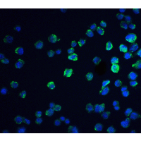 REEP3 Antibody - Immunofluorescence of REEP3 in A431 cells with REEP3 antibody at 20 µg/mL.