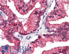 REEP5 Antibody - Human, Prostate: Formalin-Fixed Paraffin-Embedded (FFPE)