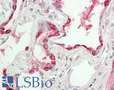 REG1A Antibody - Human Lung: Formalin-Fixed, Paraffin-Embedded (FFPE)