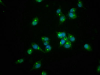 REG3A Antibody - Immunofluorescence staining of SH-SY5Y cells with REG3A Antibody at 1:166, counter-stained with DAPI. The cells were fixed in 4% formaldehyde, permeabilized using 0.2% Triton X-100 and blocked in 10% normal Goat Serum. The cells were then incubated with the antibody overnight at 4°C. The secondary antibody was Alexa Fluor 488-congugated AffiniPure Goat Anti-Rabbit IgG(H+L).