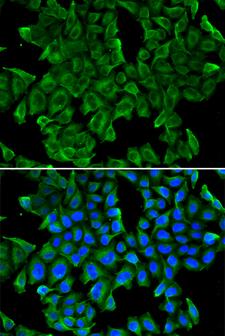 REG3G Antibody - Immunofluorescence analysis of MCF-7 cells.