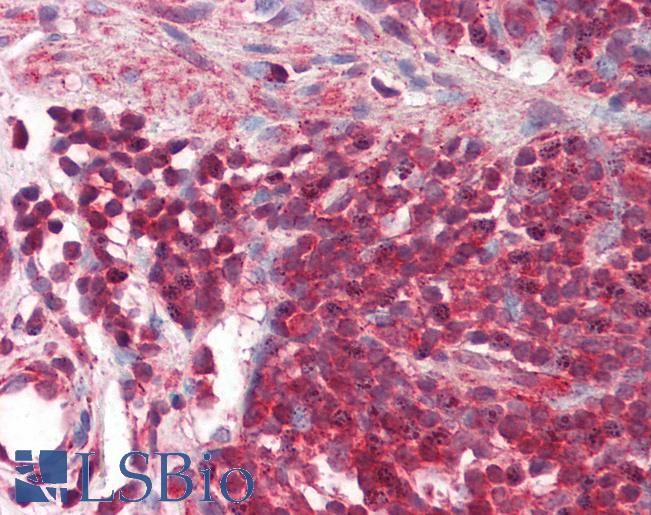 REL / C-Rel Antibody - Anti-REL / C-Rel antibody IHC staining of human colon, malt. Immunohistochemistry of formalin-fixed, paraffin-embedded tissue after heat-induced antigen retrieval.