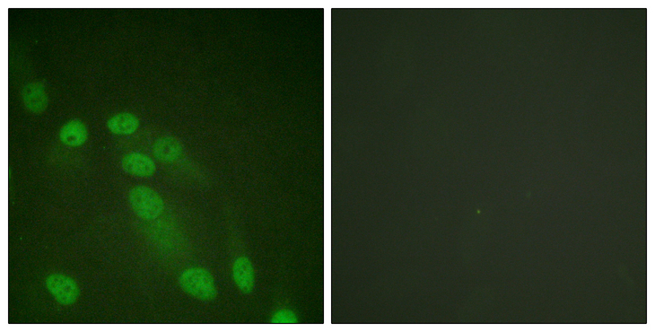 RELA / NFKB p65 Antibody - Immunofluorescence analysis of HeLa cells, using NF-kappaB p65 Antibody. The picture on the right is blocked with the synthesized peptide.