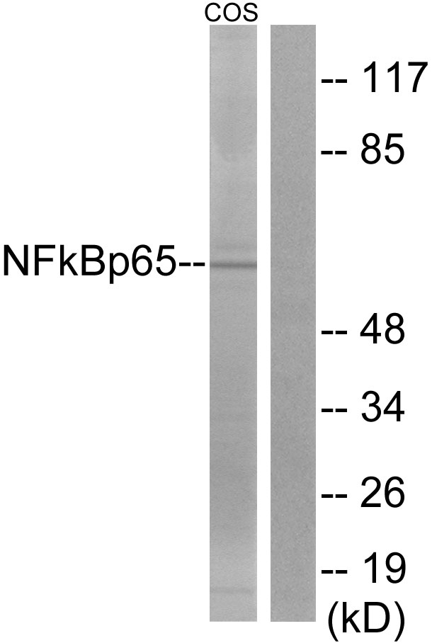 RELA / NFKB p65 Antibody - Western blot analysis of lysates from COS7 cells, treated with sorbitol 0.4M 24h, using NF-kappaB p65 Antibody. The lane on the right is blocked with the synthesized peptide.