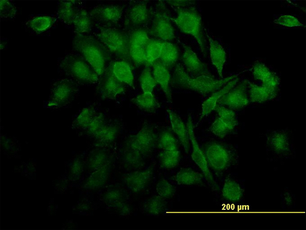 RELA / NFKB p65 Antibody - Immunofluorescence of monoclonal antibody to RELA on HeLa cell. [antibody concentration 35 ug/ml]