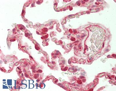 RELA / NFKB p65 Antibody - Human Lung: Formalin-Fixed, Paraffin-Embedded (FFPE)