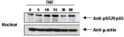 RELA / NFKB p65 Antibody - Anti-Human pS276 p65 Antibody - Western Blot. TNF Induces phosphorylation of p65 in KBM-5 cells.