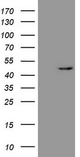 REN / Renin 1 Antibody - HEK293T cells were transfected with the pCMV6-ENTRY control (Left lane) or pCMV6-ENTRY REN (Right lane) cDNA for 48 hrs and lysed. Equivalent amounts of cell lysates (5 ug per lane) were separated by SDS-PAGE and immunoblotted with anti-REN (1:500).