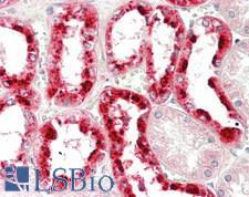 REN / Renin 1 Antibody - Human Kidney: Formalin-Fixed, Paraffin-Embedded (FFPE)