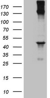 REN / Renin 1 Antibody - HEK293T cells were transfected with the pCMV6-ENTRY control (Left lane) or pCMV6-ENTRY REN (Right lane) cDNA for 48 hrs and lysed. Equivalent amounts of cell lysates (5 ug per lane) were separated by SDS-PAGE and immunoblotted with anti-REN (1:500).