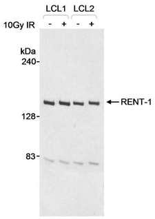 RENT1 / UPF1 Antibody - Detection of Human RENT-1 by Western Blot. Samples: Whole cell lysate (30 ug) from lymphoblastoid cell lines (EBV-immortalized B-cell from a normal individual). Antibody: Affinity purified goat anti-RENT-1 antibody used at 1 ug/ml. Detection: Chemiluminescence.