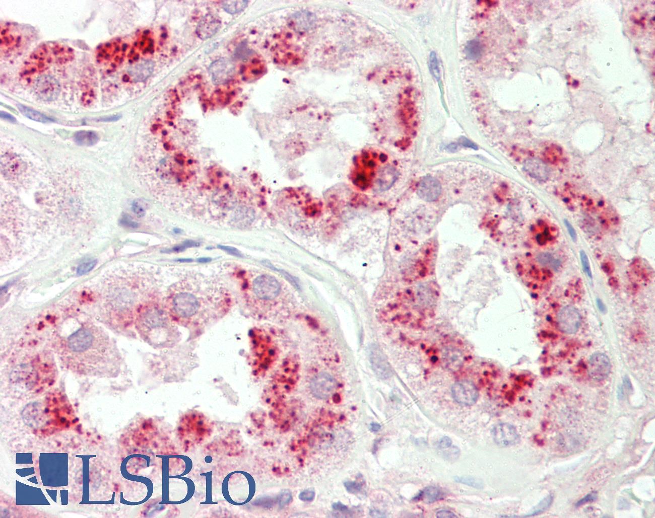 REPS1 Antibody - Anti-REPS1 antibody IHC staining of human kidney. Immunohistochemistry of formalin-fixed, paraffin-embedded tissue after heat-induced antigen retrieval. Antibody dilution 1:200.