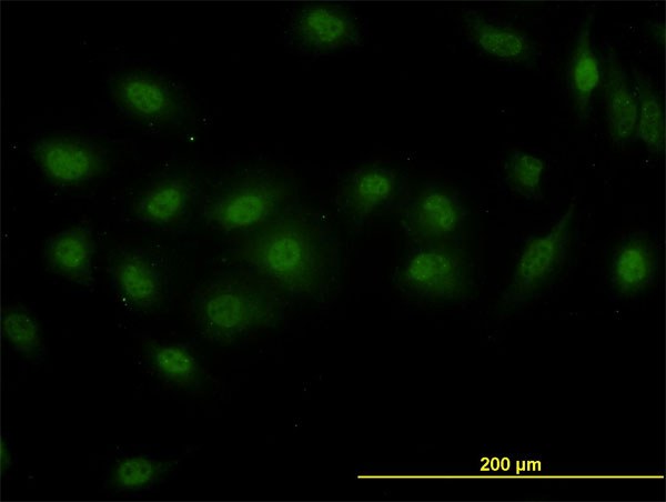 Requiem / DPF2 Antibody - Immunofluorescence of monoclonal antibody to DPF2 on HeLa cell (antibody concentration 10 ug/ml).