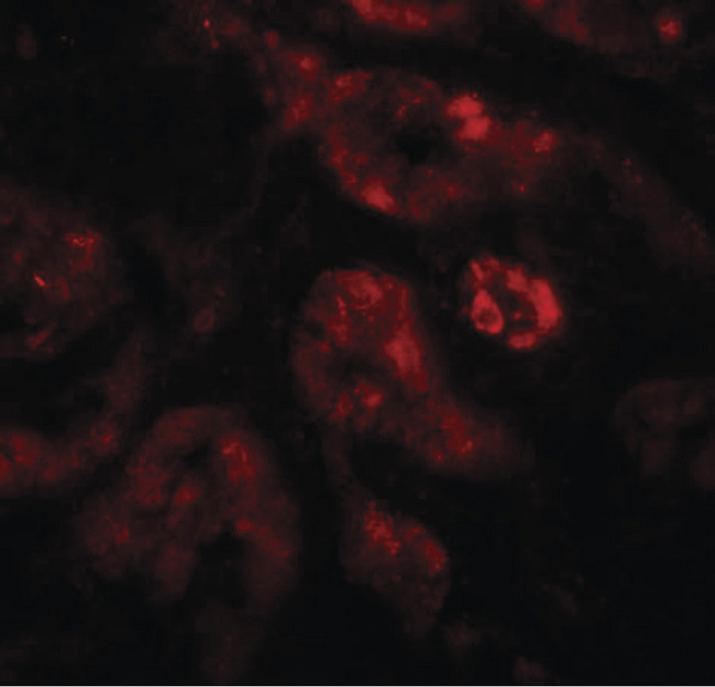 Requiem / DPF2 Antibody - Immunofluorescence of REQUIEM in human kidney tissue with REQUIEM antibody at 20 ug/ml.
