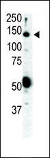 RET Antibody - Western blot of anti-Ret antibody in SKBR3 cell lysate. Ret (arrow) was detected using purified antibody. Secondary HRP-anti-rabbit was used for signal visualization with chemiluminescence.