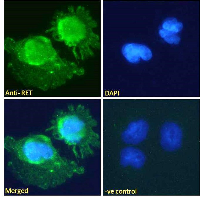 RET Antibody - Immunofluorescence analysis of paraformaldehyde fixed U251 cells, permeabilized with 0.15% Triton. Primary incubation 1hr (10ug/ml) followed by Alexa Fluor 488 secondary antibody (2ug/ml), showing cytoplasmic staining. The nuclear stain is DAPI (blue). Negative control: Unimmunized goat IgG (10ug/ml) followed by Alexa Fluor 488 secondary antibody (2ug/ml).