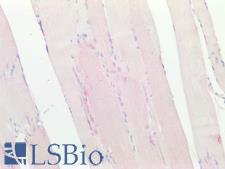 RET Antibody - Human Skeletal Muscle: Formalin-Fixed, Paraffin-Embedded (FFPE)
