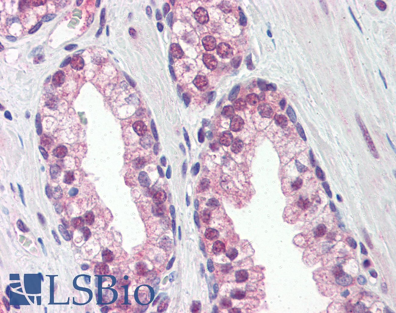 REXO1 / REX1 Antibody - Anti-REXO1 antibody IHC of human prostate. Immunohistochemistry of formalin-fixed, paraffin-embedded tissue after heat-induced antigen retrieval. Antibody concentration 5 ug/ml.