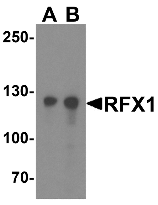RFX / RFX1 Antibody - Western blot analysis of RFX1 in HeLa cell lysate with RFX1 antibody at (A) 1 and (B) 2 ug/ml.