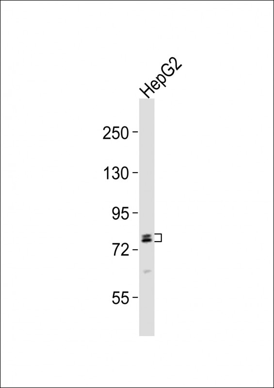 RFX4 Antibody - Anti-RFX4 Antibody at 1:2000 dilution + HepG2 whole cell lysates Lysates/proteins at 20 ug per lane. Secondary Goat Anti-Rabbit IgG, (H+L), Peroxidase conjugated at 1/10000 dilution Predicted band size : 83 kDa Blocking/Dilution buffer: 5% NFDM/TBST.