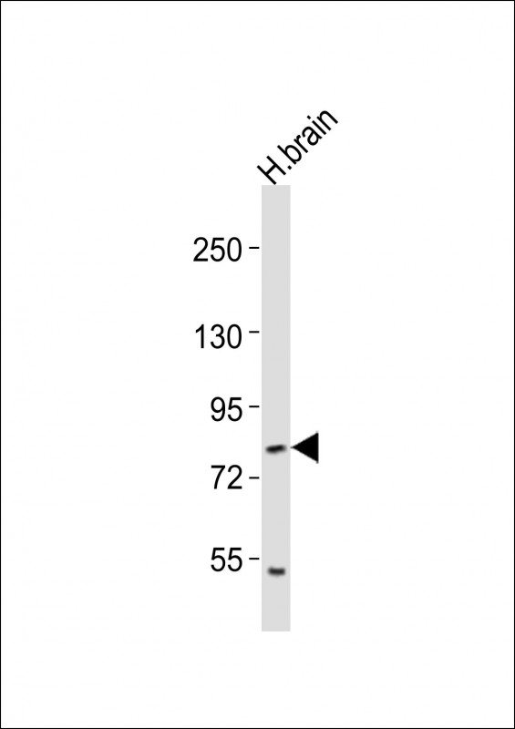 RFX4 Antibody - Anti-RFX4 Antibody at 1:2000 dilution + human brain lysates Lysates/proteins at 20 ug per lane. Secondary Goat Anti-Rabbit IgG, (H+L), Peroxidase conjugated at 1/10000 dilution Predicted band size : 83 kDa Blocking/Dilution buffer: 5% NFDM/TBST.