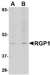 RGP1 Antibody - Western blot of RGP1 in human heart tissue lysate with RGP1 antibody at (A) 1 and (B) 2 ug/ml.