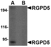 RGPD5 Antibody - Western blot of RGPD5 in EL4 cell lysate with RGPD5 antibody at 1 ug/ml in (A) the absence and (B) the presence of blocking peptide.