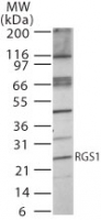 RGS1 Antibody - Western blot of RGS1 in Jurkat cell lysate using antibody at 2 ug/ml.