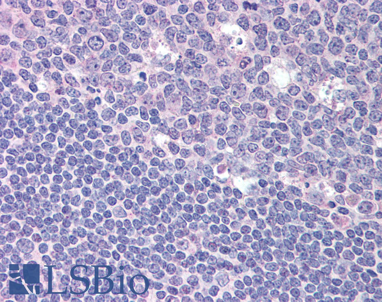 RGS1 Antibody - Anti-RGS1 antibody IHC of human tonsil. Immunohistochemistry of formalin-fixed, paraffin-embedded tissue after heat-induced antigen retrieval. Antibody concentration 20 ug/ml.