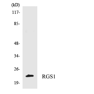 RGS1 Antibody - Western blot of the lysates from 293 cells using RGS1 antibody.