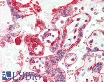 RGS1 Antibody - Human Placenta: Formalin-Fixed, Paraffin-Embedded (FFPE)