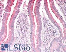 RGS18 Antibody - Human Small Intestine: Formalin-Fixed, Paraffin-Embedded (FFPE)