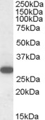 RGS18 Antibody - RGS18 antibody (1µg/ml) staining of Human Peripheral Blood Mononucleocytes lysate (35µg protein in RIPA buffer). Detected by chemiluminescence.
