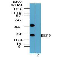 RGS19 Antibody - Western blot of RGS19 in mouse placenta lysate in the 1) absence and 2) presence of immunizing peptide using RGS19 Antibody  at 1.0 ug/ml.