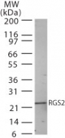 RGS2 Antibody - Western blot of RGS2 in human heart lysate using antibody at 2 ug/ml.