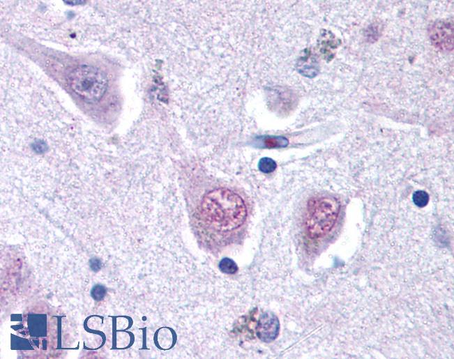 RGS2 Antibody - Anti-RGS2 antibody IHC of human brain, cortex. Immunohistochemistry of formalin-fixed, paraffin-embedded tissue after heat-induced antigen retrieval. Antibody concentration 20 ug/ml.