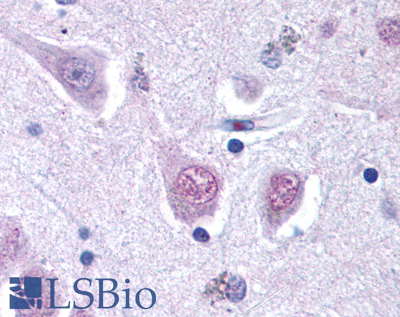 RGS2 Antibody - Anti-RGS2 antibody IHC of human brain, cortex. Immunohistochemistry of formalin-fixed, paraffin-embedded tissue after heat-induced antigen retrieval. Antibody concentration 20 ug/ml.