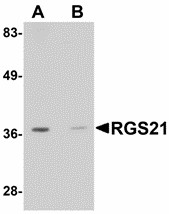 RGS21 Antibody - Western blot of RGS21 in HepG2 cell lysate with RGS21 antibody at 0.5 ug/ml in (A) the absence and (B) the presence of blocking peptide.