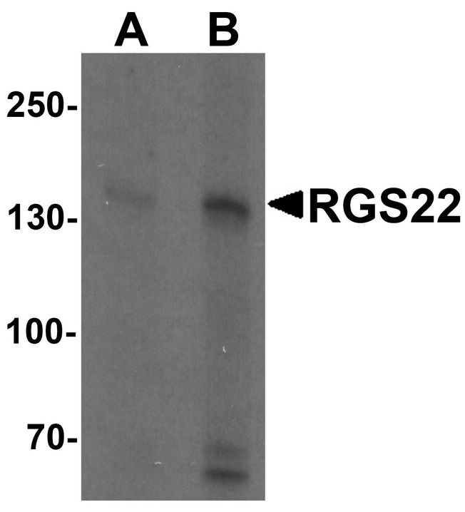 RGS22 Antibody - Western blot analysis of RGS22 in Jurkat cell lysate with RGS22 antibody at (A) 1 and (B) 2 ug/ml.
