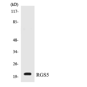 RGS5 Antibody - Western blot analysis of the lysates from HepG2 cells using RGS5 antibody.