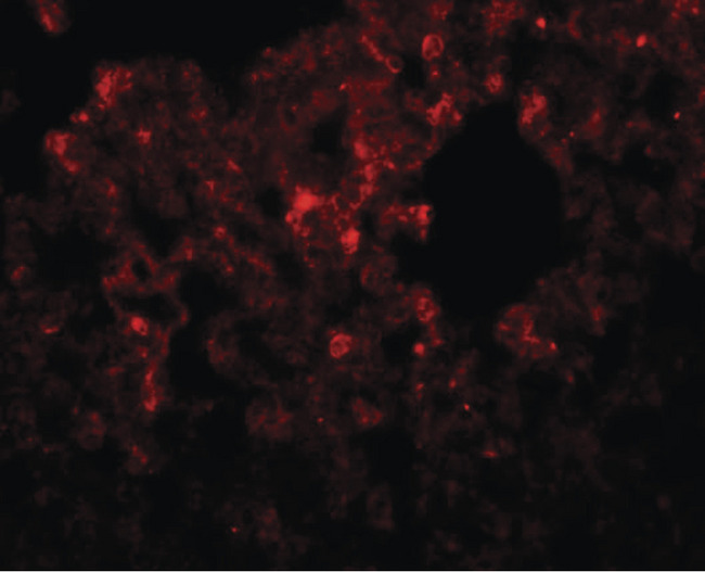RHBDD3 Antibody - Immunofluorescence of RHBDD32 in rat lung tissue with RHBDD3 antibody at 20 ug/ml.