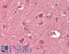 RHEB Antibody - Human Brain, Cortex: Formalin-Fixed, Paraffin-Embedded (FFPE)