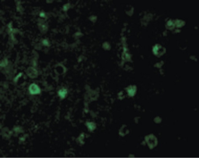 RHEB Antibody - Immunofluorescence of Rheb in Mouse Brain cells with Rheb antibody at 20 ug/ml.