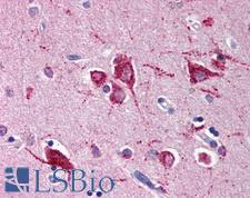 RHEB Antibody - Anti-RHEB antibody IHC of human brain, cortex. Immunohistochemistry of formalin-fixed, paraffin-embedded tissue after heat-induced antigen retrieval. Antibody concentration 5 ug/ml.