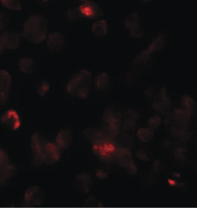 Rho Kinase / ROCK1 Antibody - Immunofluorescence of ROCK1 in 293 cells with ROCK1 antibody at 20 ug/ml.