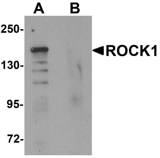 Rho Kinase / ROCK1 Antibody - Western blot analysis of ROCK1 in 293 cell lysate with ROCK1 antibody at 1 ug/ml in (A) the absence and (B) the presence of blocking peptide.
