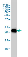 RHOA Antibody - Western blot of RHOA expression in HL-60 cell lysate.