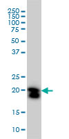 RHOA Antibody - Western blot of RHOA expression in HeLa cell lysate.
